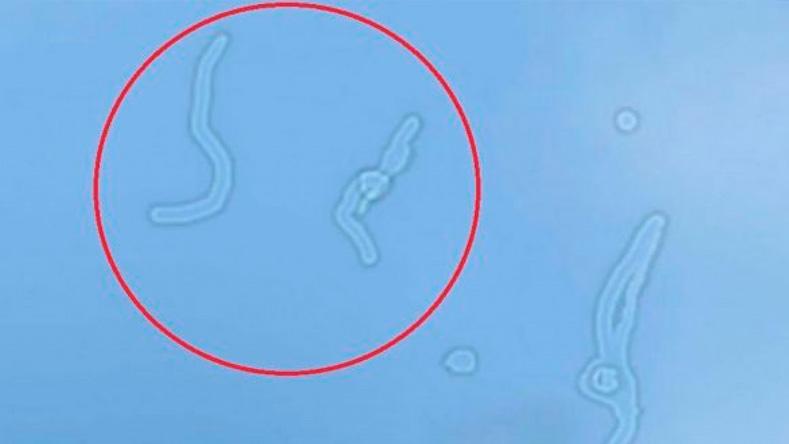 Як позбутися летючих мушок перед очима?